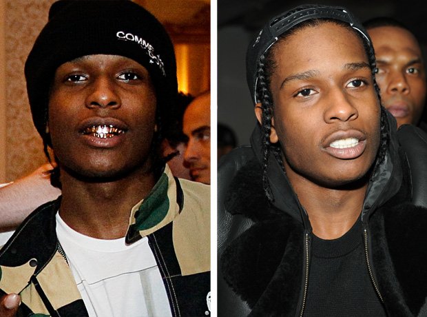 A$AP Rocky with teeth grills