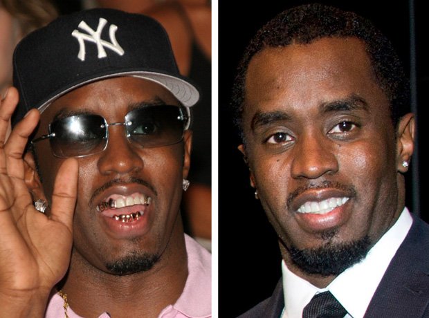 P Diddy with and without teeth grills