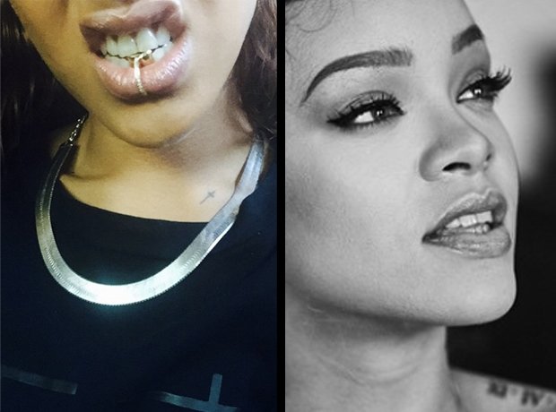 Rihanna with and without teeth grillz