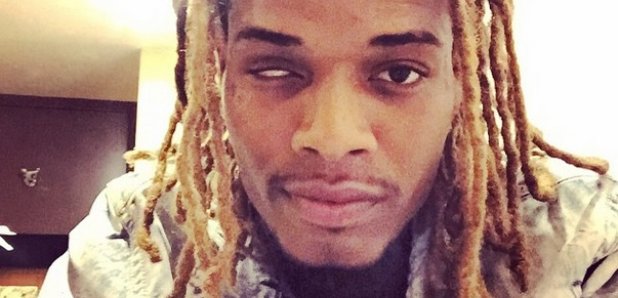 Fetty Wap