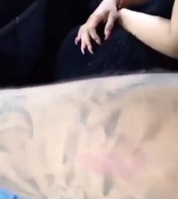 Rob Kardashian Blac Chyna Scratches on arm