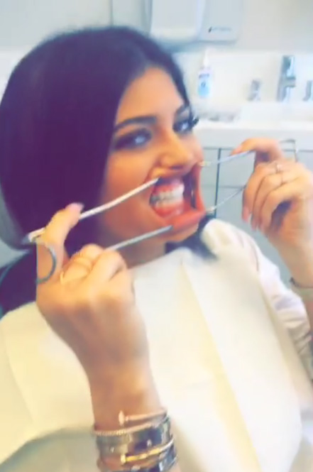 Kylie Jenner teeth snapchat