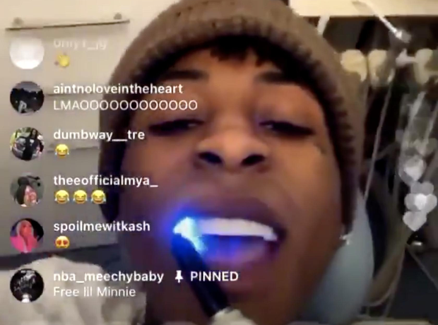 NBA Youngboy teeth